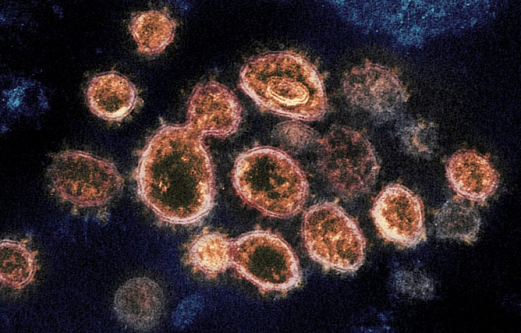 Biến thể mới Lambda virus có khả năng đề kháng với vaccine