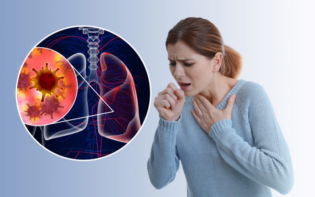 Chủng cúm A/H3N2 gây nhiều biến chứng nặng
